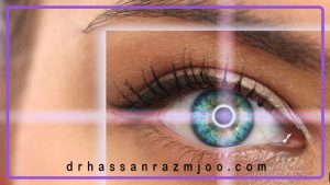 مزایای لیزیک چشم چیست؟
