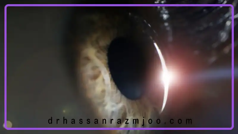 نقش نور طبیعی در سلامت بینایی