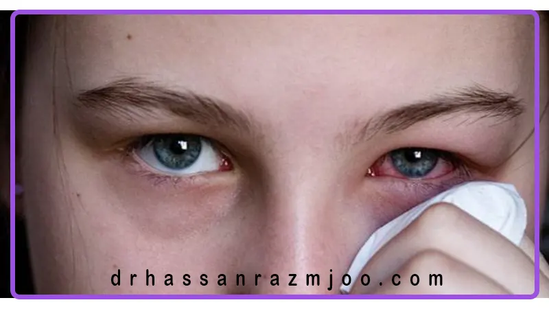 راه‌های انتقال ویروس‌های چشمی