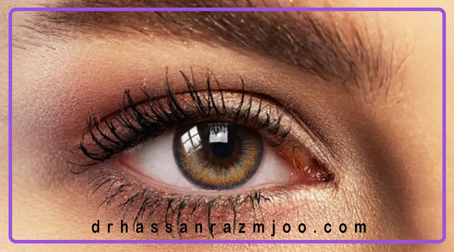 لنزهای رنگی؛ ایمن یا خطرناک