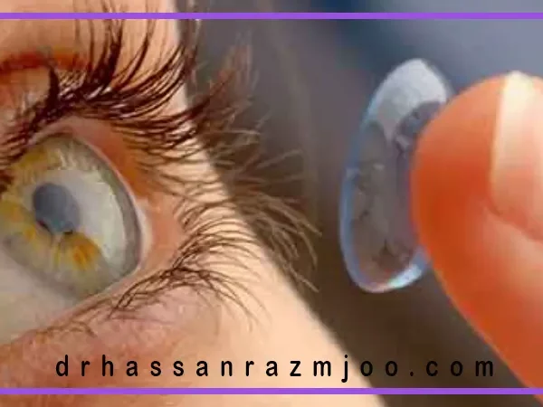 چگونه بهترین لنز تماسی را انتخاب کنیم؟
