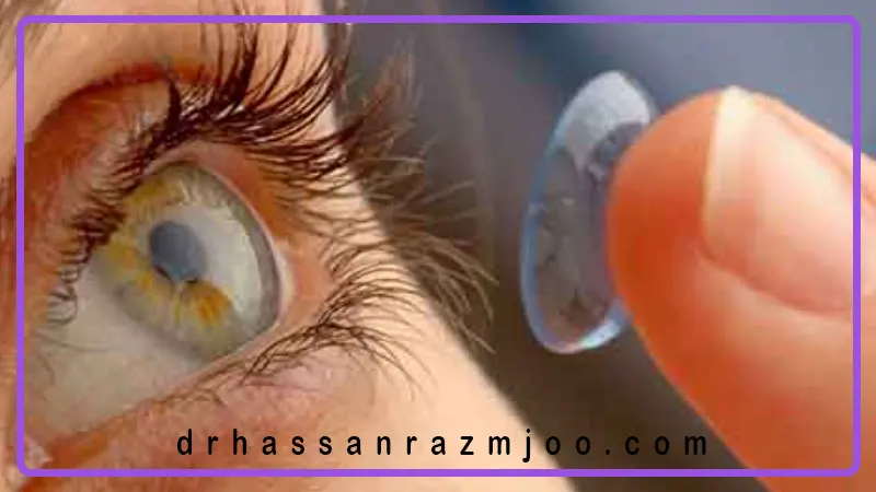 چگونه بهترین لنز تماسی را انتخاب کنیم؟