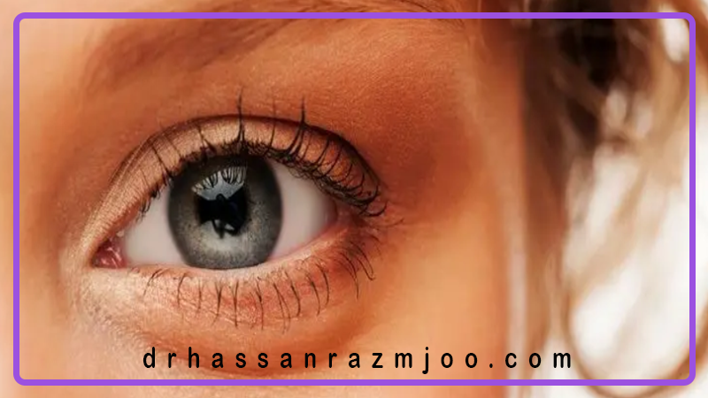شست‌وشو و نگهداری صحیح لنز چشم