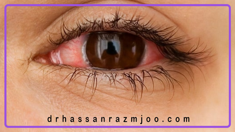 فواید پلک زدن برای سلامت چشم