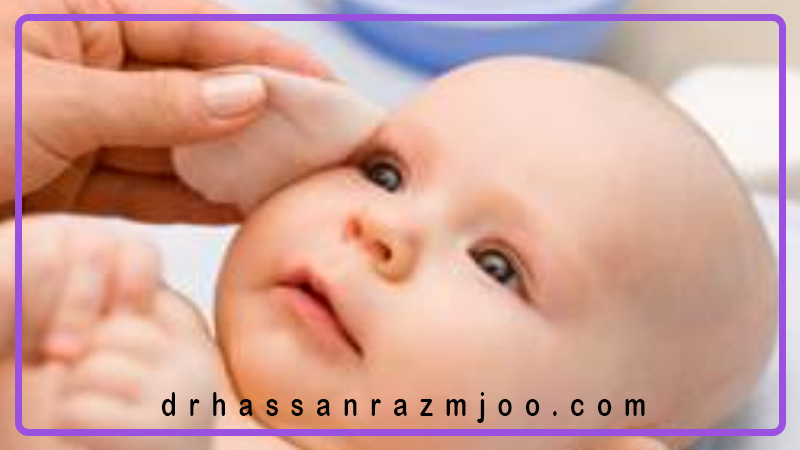 مراقبت از چشم در نوزادان