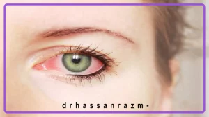 علائم اورژانسی چشمی