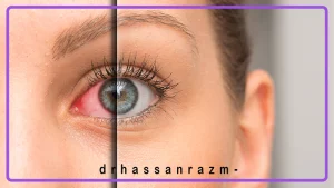 مشکلات چشمی مرتبط با بیماری کلیوی