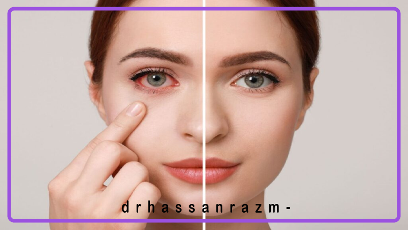 مشکلات چشمی مرتبط با بیماری کلیوی
