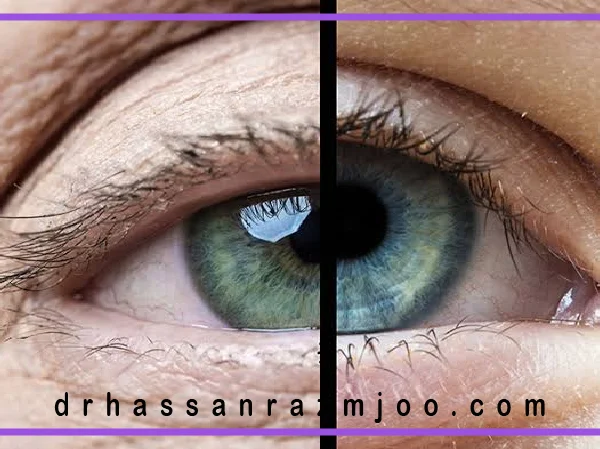سلامت چشم در سنین مختلف