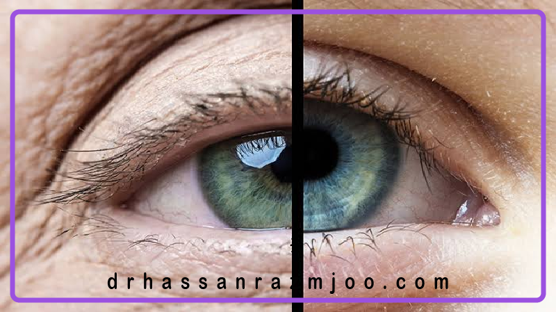 سلامت چشم در سنین مختلف
